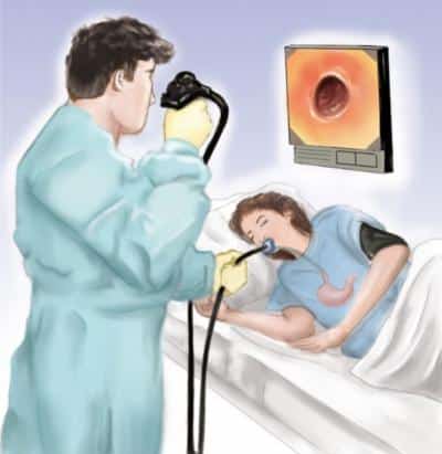 foto de paciente fazendo endoscopia