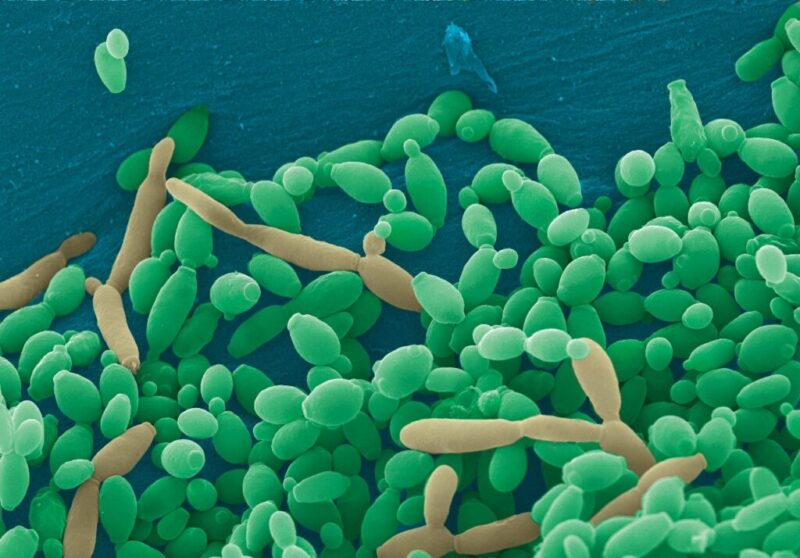 imagem dos fungos Candida albicans por miscroscópio
