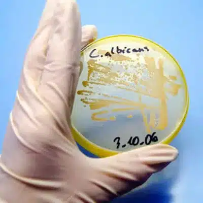 amostragem de fungos Candida albicans