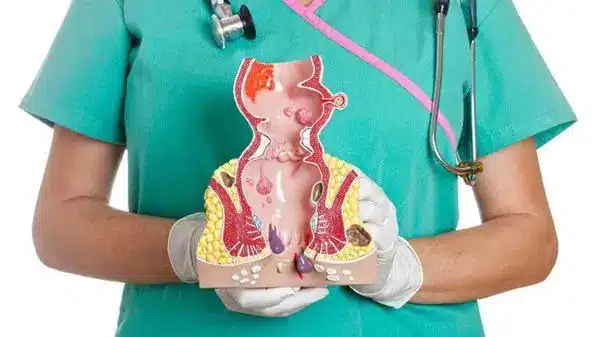 médica mostrando o intestino por dentro com as colonias de candida em crescimento