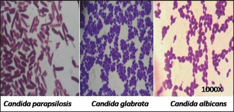exemplos microscópicos de Candida parapsilosis, glabrata e albicans