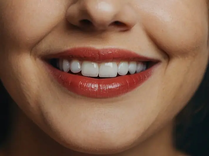 imagem de um sorriso saudável e livre da monilíase oral